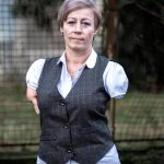 Aby som mohla pracovat potrebujem si len vyzu ponozky hovori zena bez ruk