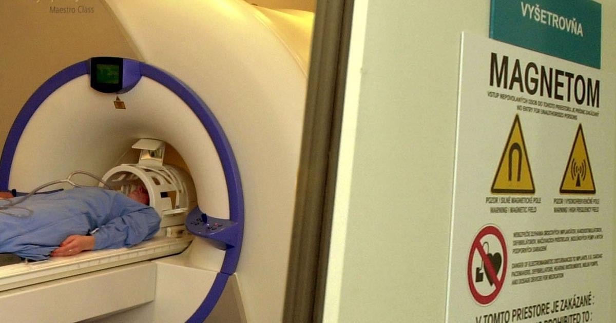 Rokovania medzi Doverou a spolocnostou Pro Diagnostic Group prebiehaju aj nadalej